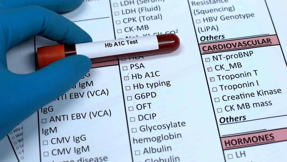 Hemoglobin A1C Test: What it Means to You