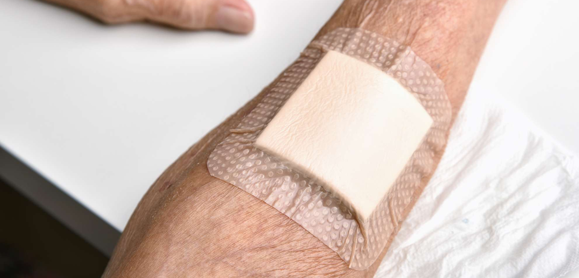 Type 2 Diabetes - Slow Wound Healing